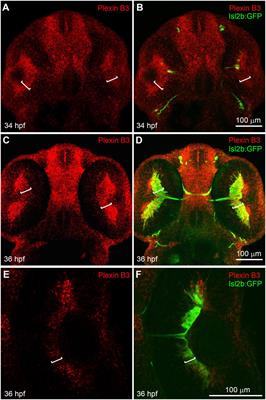 Plexin B3 guides axons to cross the midline in vivo